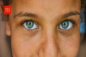 शरीर पर जन्म से दिखने वाले निशान का रहस्य, बर्थमार्क के कारण और कब जरूरी है डॉक्टर की सलाह