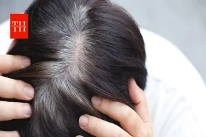 20 की उम्र में सफेद बाल क्यों? क्या आयुर्वेद सच में फिर से काले कर सकता है बाल, एक्सपर्ट्स ने बताया सच!